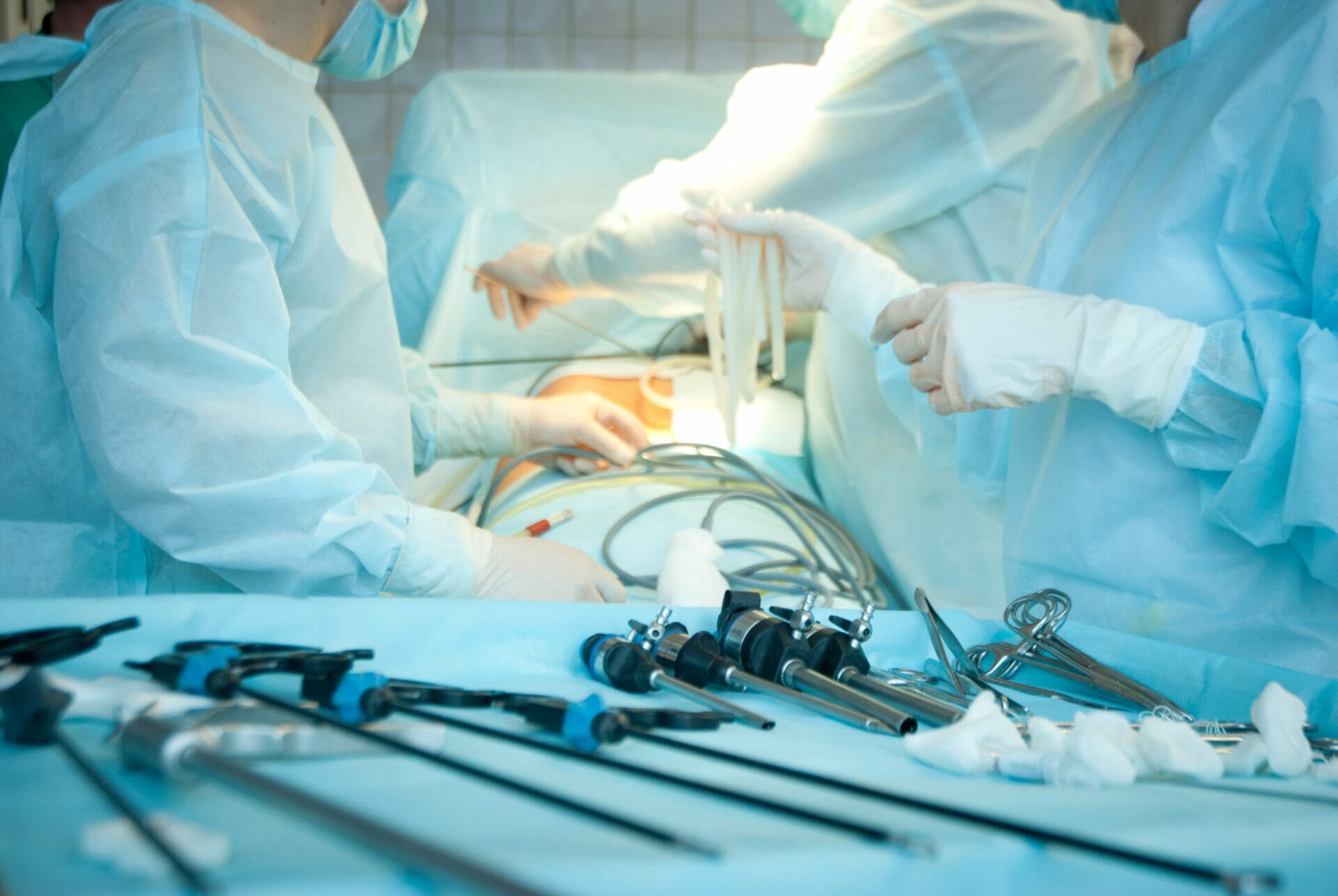 3 surgeons carrying out gallbladder removal surgery in the operation theatre