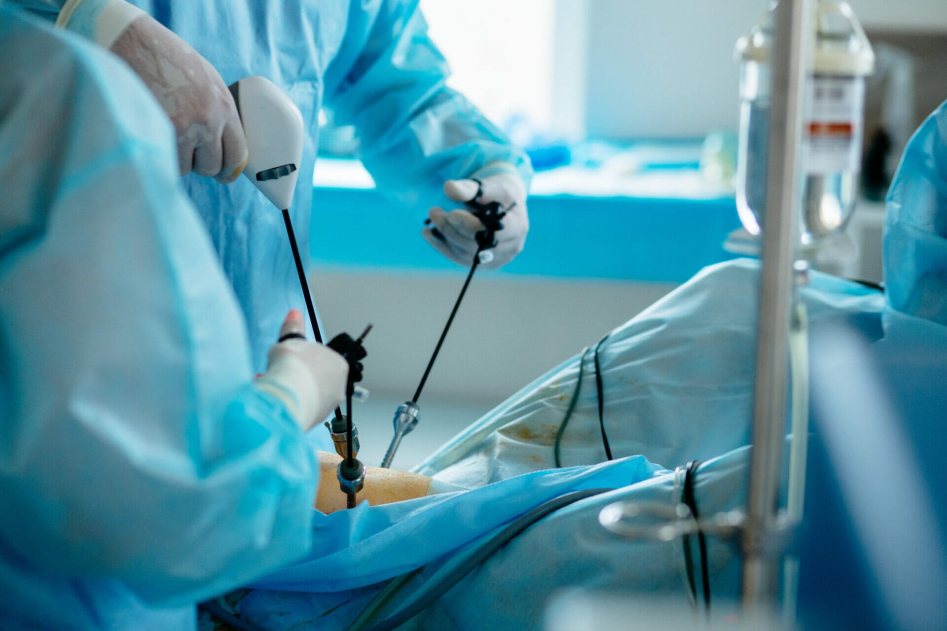Unrecognizable surgeon's holing the instrument in abdomen of patient. The surgeon's doing laparoscopic surgery in the operating room. Minimally invasive surgery. Close up
